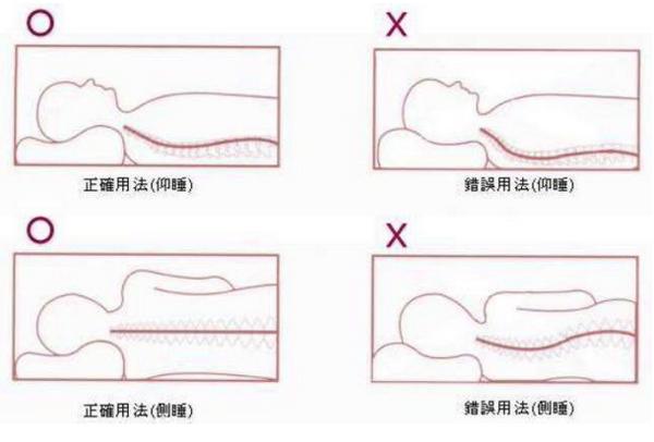 颈椎病的人用枕头还是不用枕头好,神经根型颈椎病选哪种枕头最合适