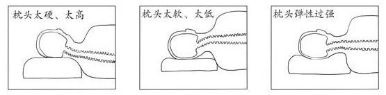 颈椎病的人用枕头还是不用枕头好,神经根型颈椎病选哪种枕头最合适