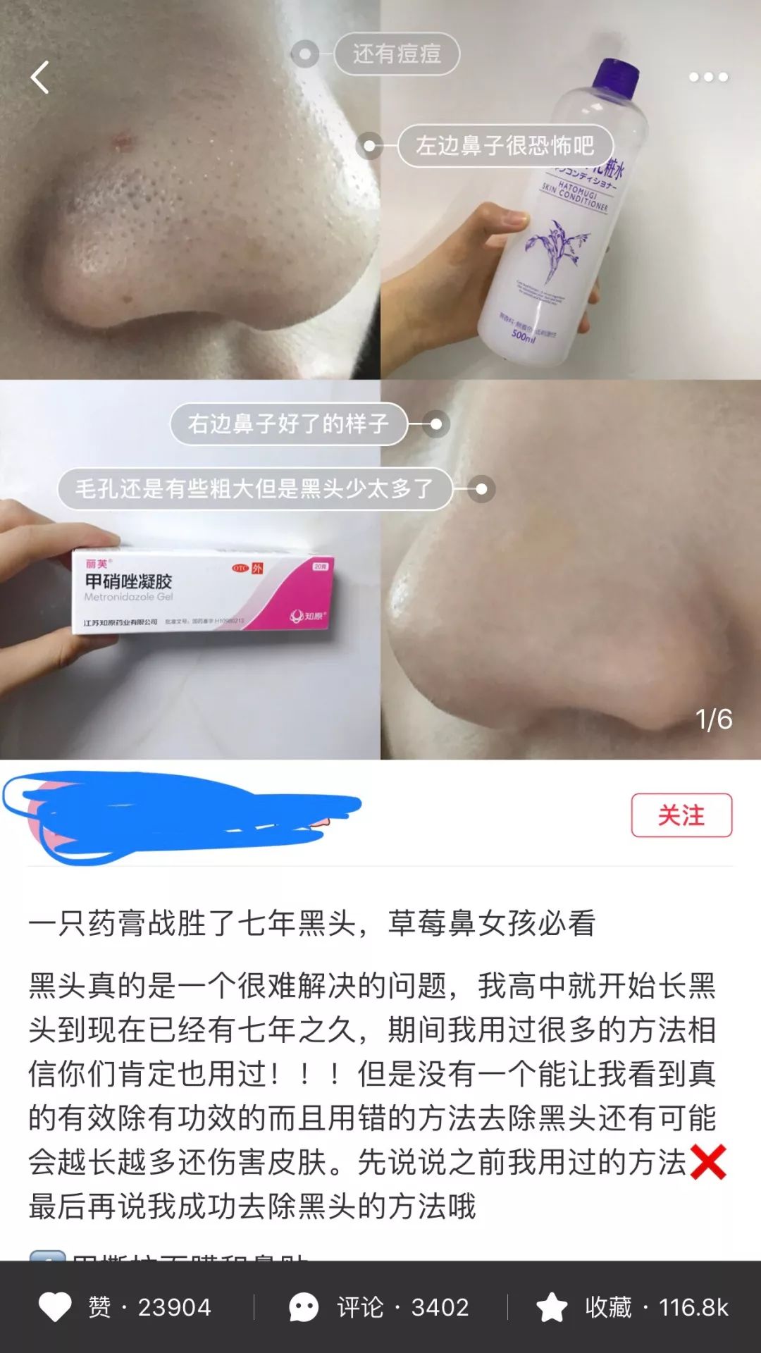 维生素B6去闭口、缩毛孔……这些爆红的变美“捷径”，到底是不是骗人的？