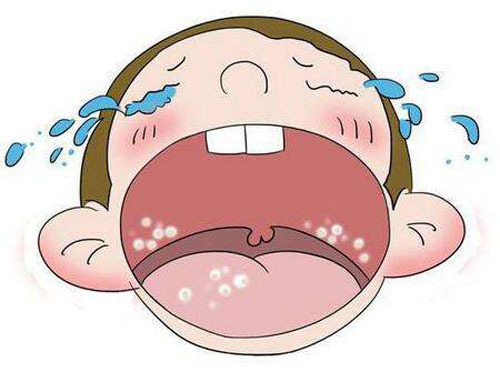 新生儿鹅口疮科普知识,新生儿吃抗生素得鹅口疮