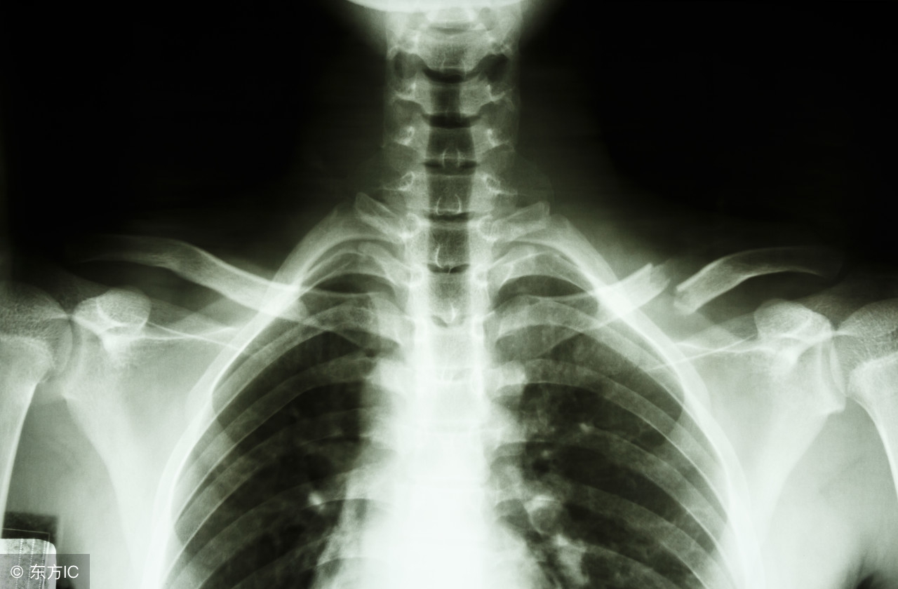 宝宝骨折保守治疗跟手术治疗,为什么儿童骨折医生建议保守治疗