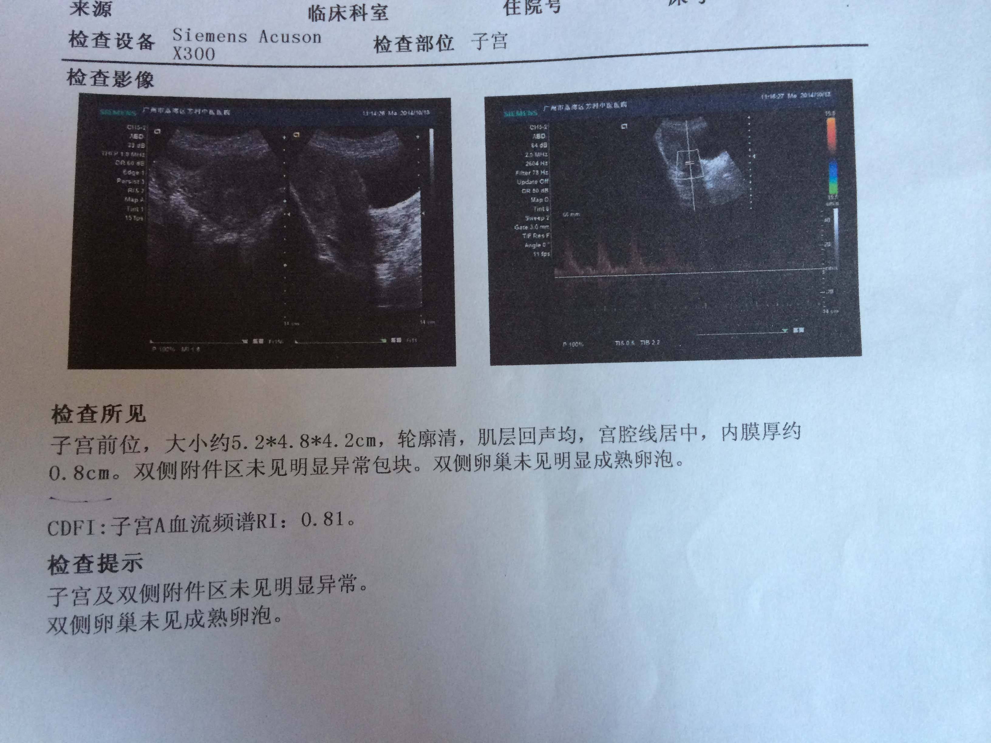 不孕不育不排卵怎么办,不排卵怎么治好