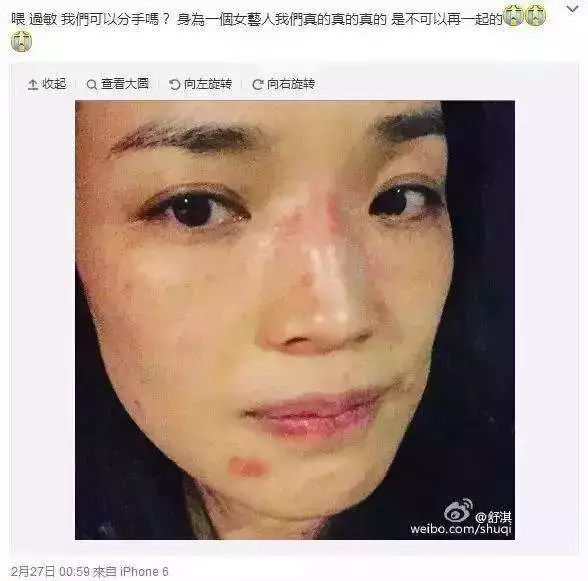 晒黑怎样快速恢复美白,假期晒黑如何美白