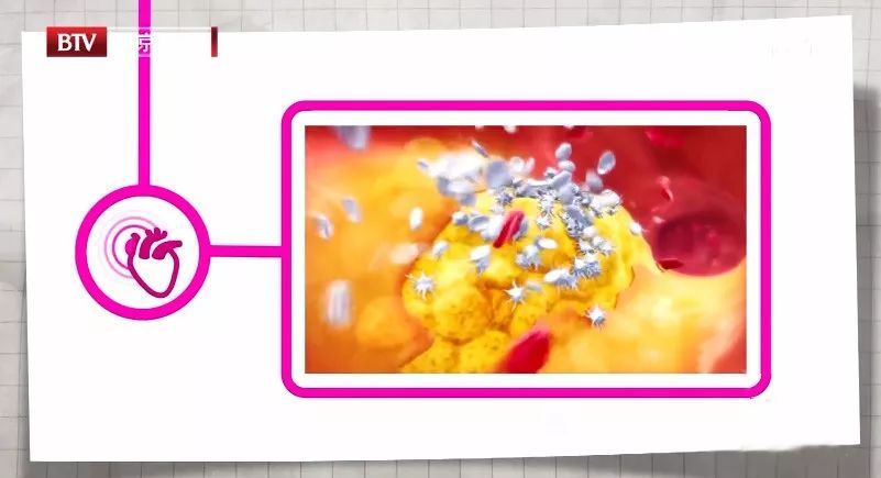 胸痛突发,感到胸痛要警惕四种病