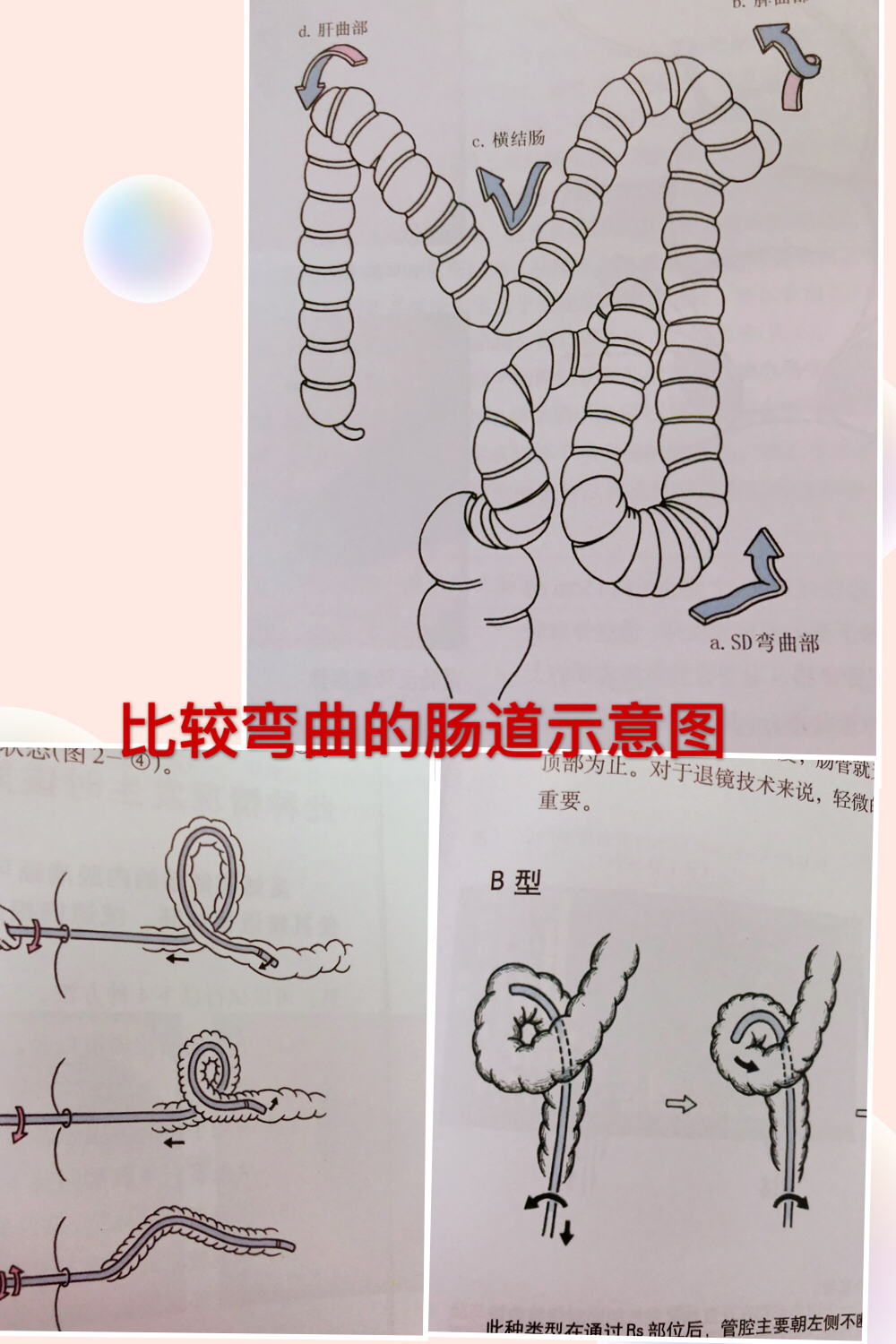 做肠镜前饮食有什么注意,在做肠镜之前饮食方面应注意什么