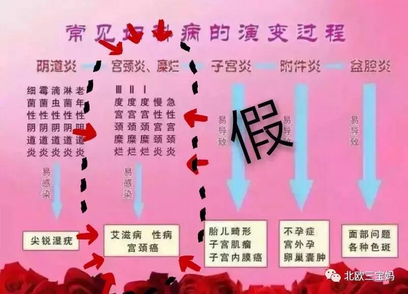 宫颈糜烂变为宫颈癌需要多久,宫颈糜烂能发展到宫颈癌吗