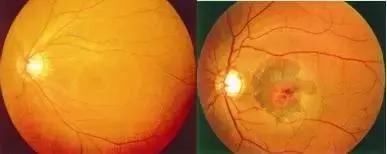 眼镜的正确使用和错误使用图片,正确的用眼方法和保护眼睛的方法