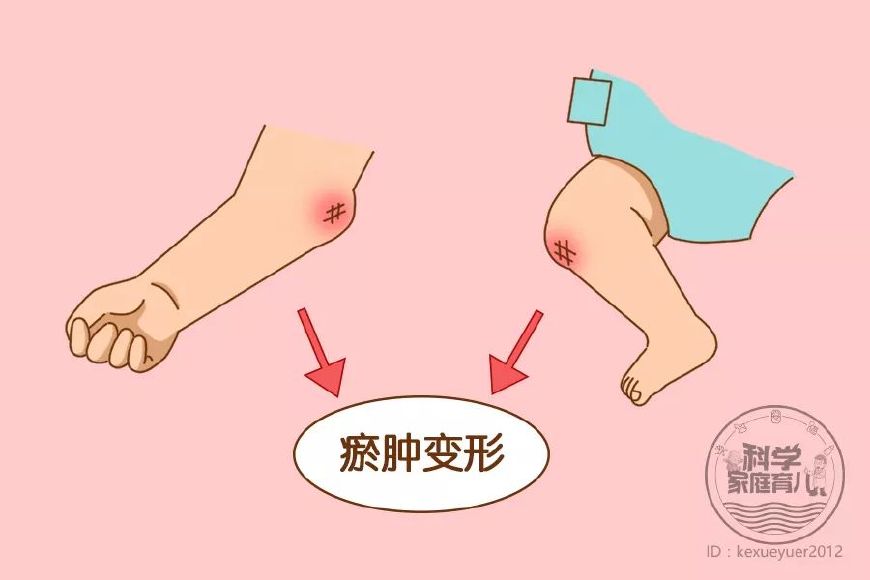 宝宝受伤的五个危险信号,宝宝紧急救护