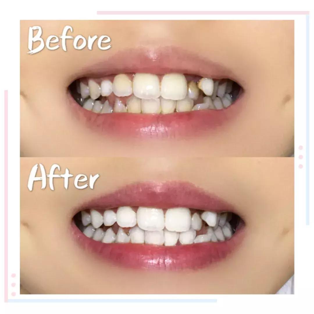 囧！天仙脸配上大黄牙，这是什么操作？！