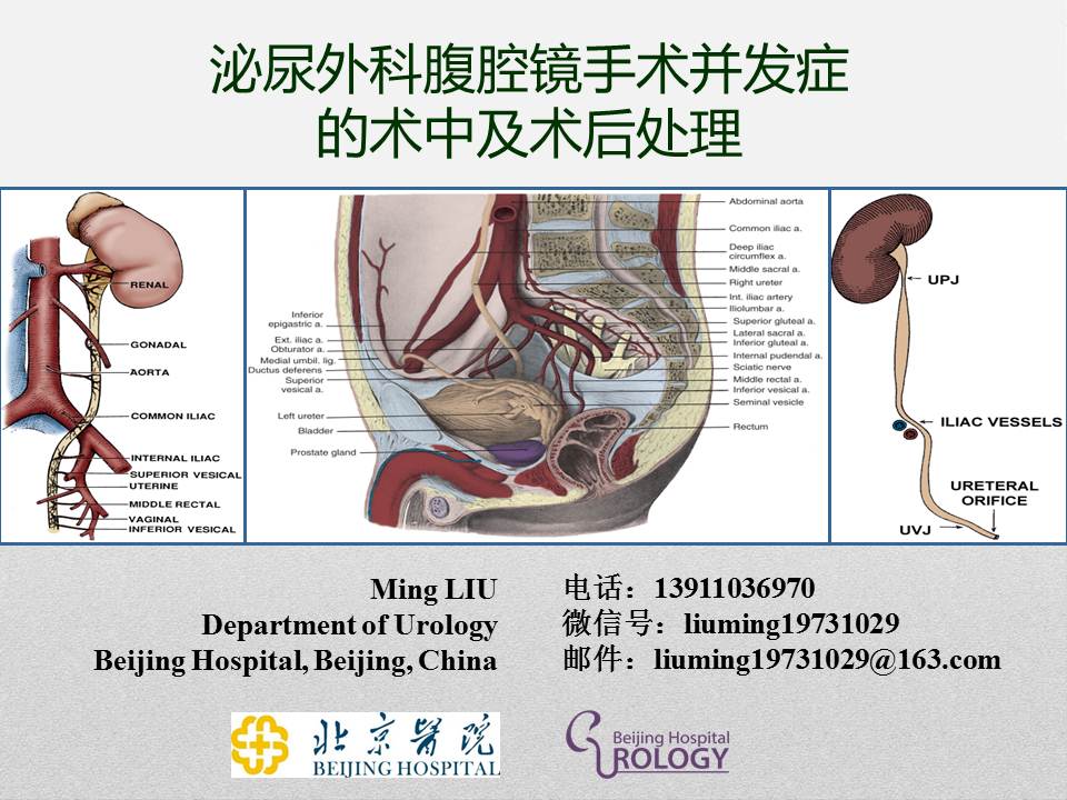 泌尿外科腹腔镜手术适应症,泌尿外科腹腔镜并发症