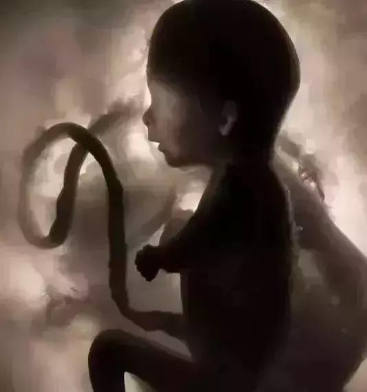 羊水为什么叫羊水秒懂知识,12周羊水什么样子