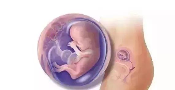 羊水为什么叫羊水秒懂知识,12周羊水什么样子