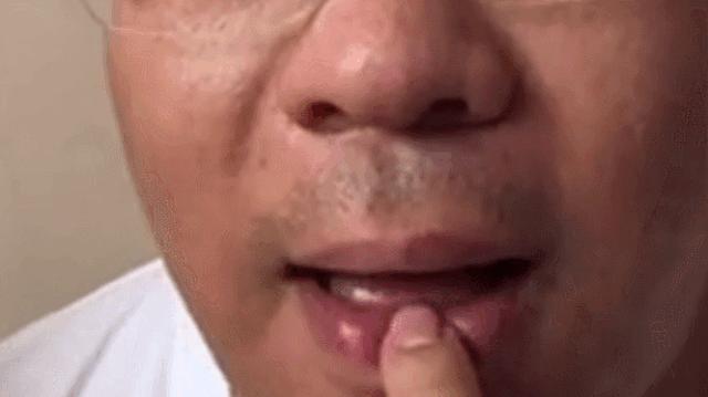 萨克斯演奏高低音口型区别,萨克斯演奏的含嘴方式