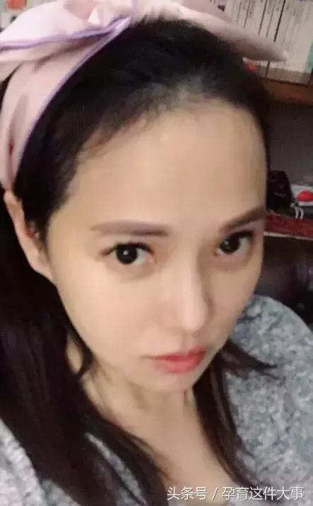 胡杏儿产后发际线变高:生个娃等于出家当和尚?