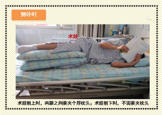 人工股骨头置换术术后教学查房,人工髋关节置换术后护理注意事项