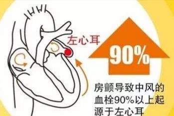 轻微脑梗塞怎么办?注意好这5件事,就不会有生命危险!