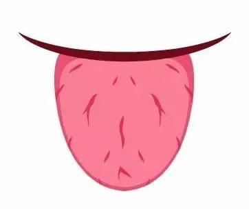 7种舌头暗示健康问题,各种病症舌头的颜色