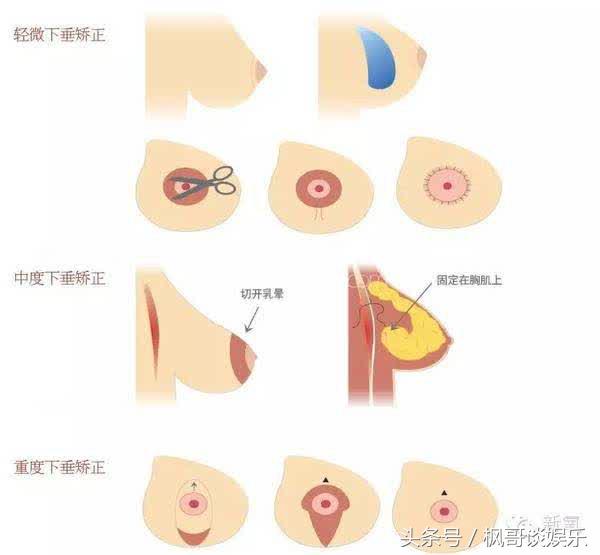 乳神柳岩变成这样，王菲志玲嘉玲纷纷表示不服！