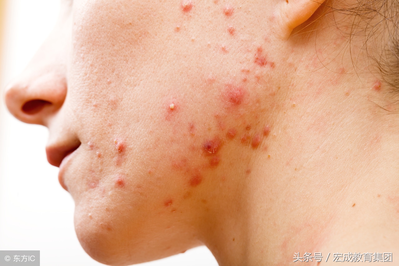 宝宝常见的皮肤病用药,常见皮肤病用药药膏有哪些