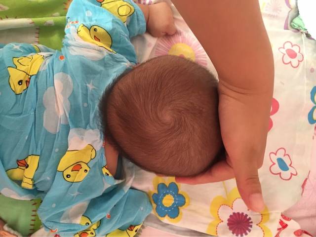 宝宝睡觉头总是偏一边如何纠正,头不由自主的往一边偏是怎么回事