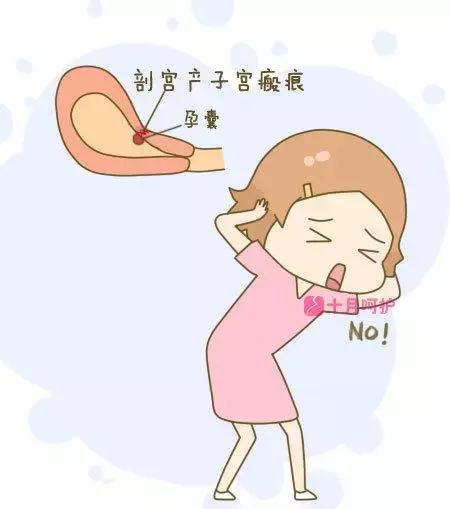 剖宫产体验,剖宫产和顺产到底哪个好