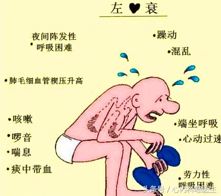 心衰的6个早期信号,心脏病患者心衰有什么症状