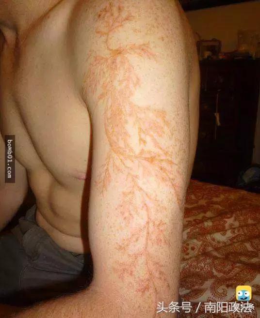 被雷劈是种什么样的体验？看完简直身受同感