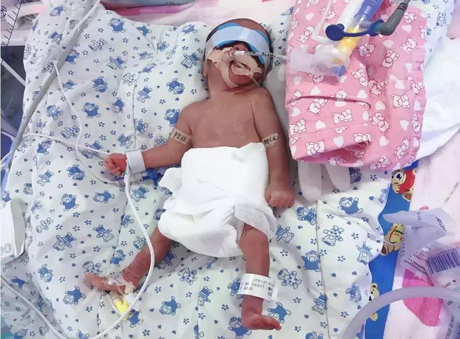 出生2斤多宝宝,出生2斤重的宝宝