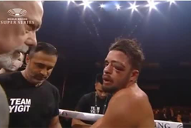 重量级拳击手重拳对普通人的伤害,拳击手的拳力为啥那么大