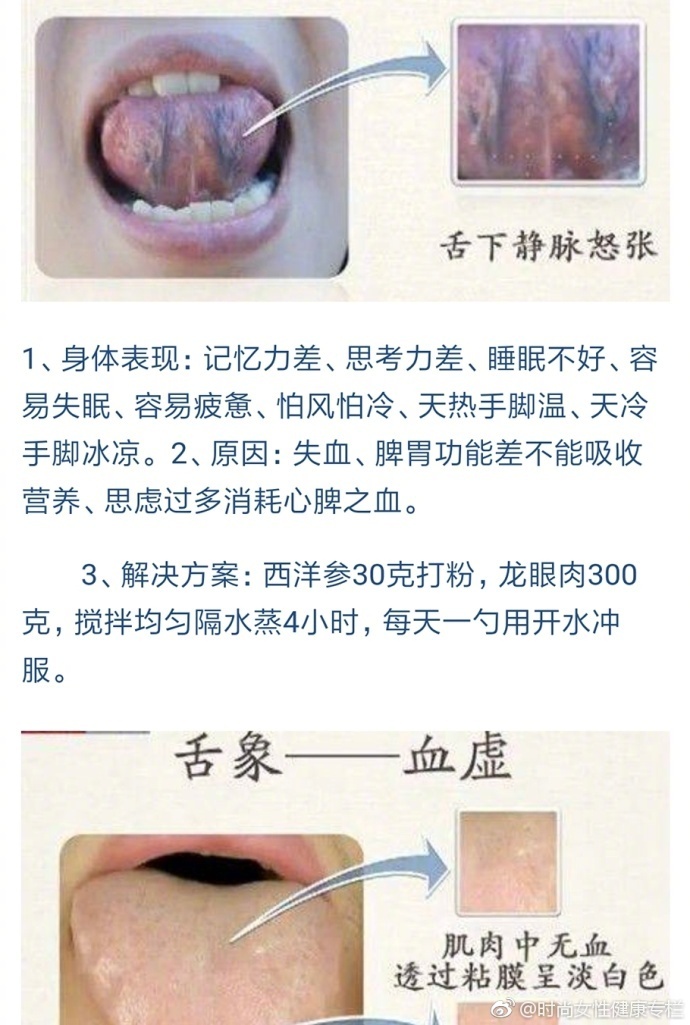 中医教你看舌头病,老中医为什么要看你的舌头图片