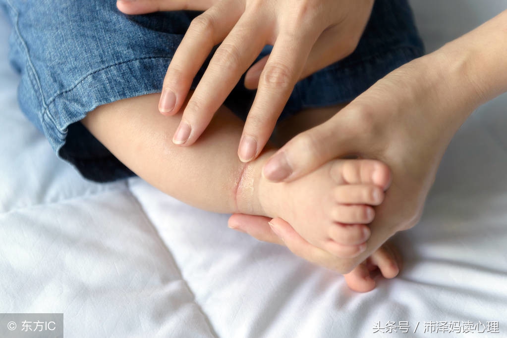 泡脚导致了足温过高,婴幼儿泡脚会影响足弓发育吗