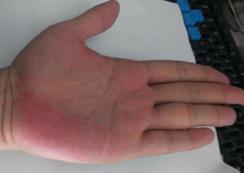 喝降糖茶还吃药吗,降糖茶和降糖药有区别吗