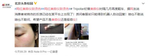 315——SKG、初普、小熊产品存致伤隐患