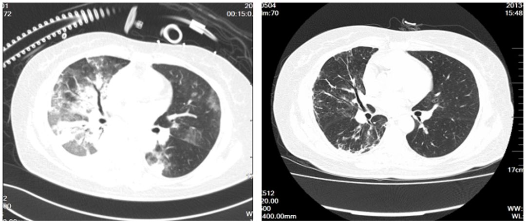 陈荣昌在哪个医院,陈荣昌广州呼吸疾病研究所所长