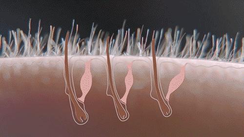 米诺地尔为什么不能用于女性脱发 (脱发10年米诺地尔真的可以生发吗)