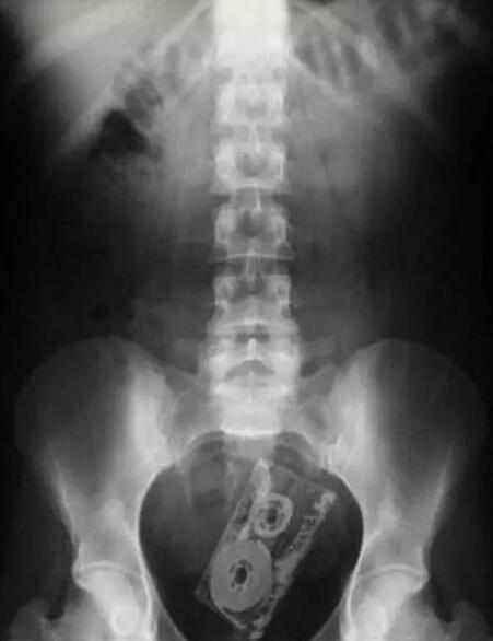 不作死就不会死看看你中了几条,不作死就不会死让人看的头皮发麻