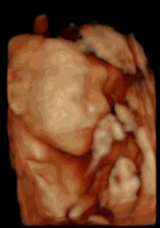 妇幼微科普,河南省妇幼保健院四维彩超预约