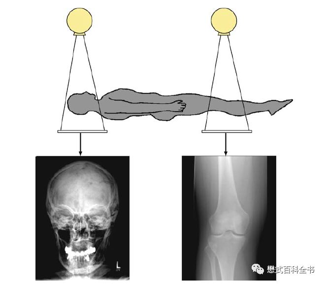 ct排数和层数区别,ct排与层的区别