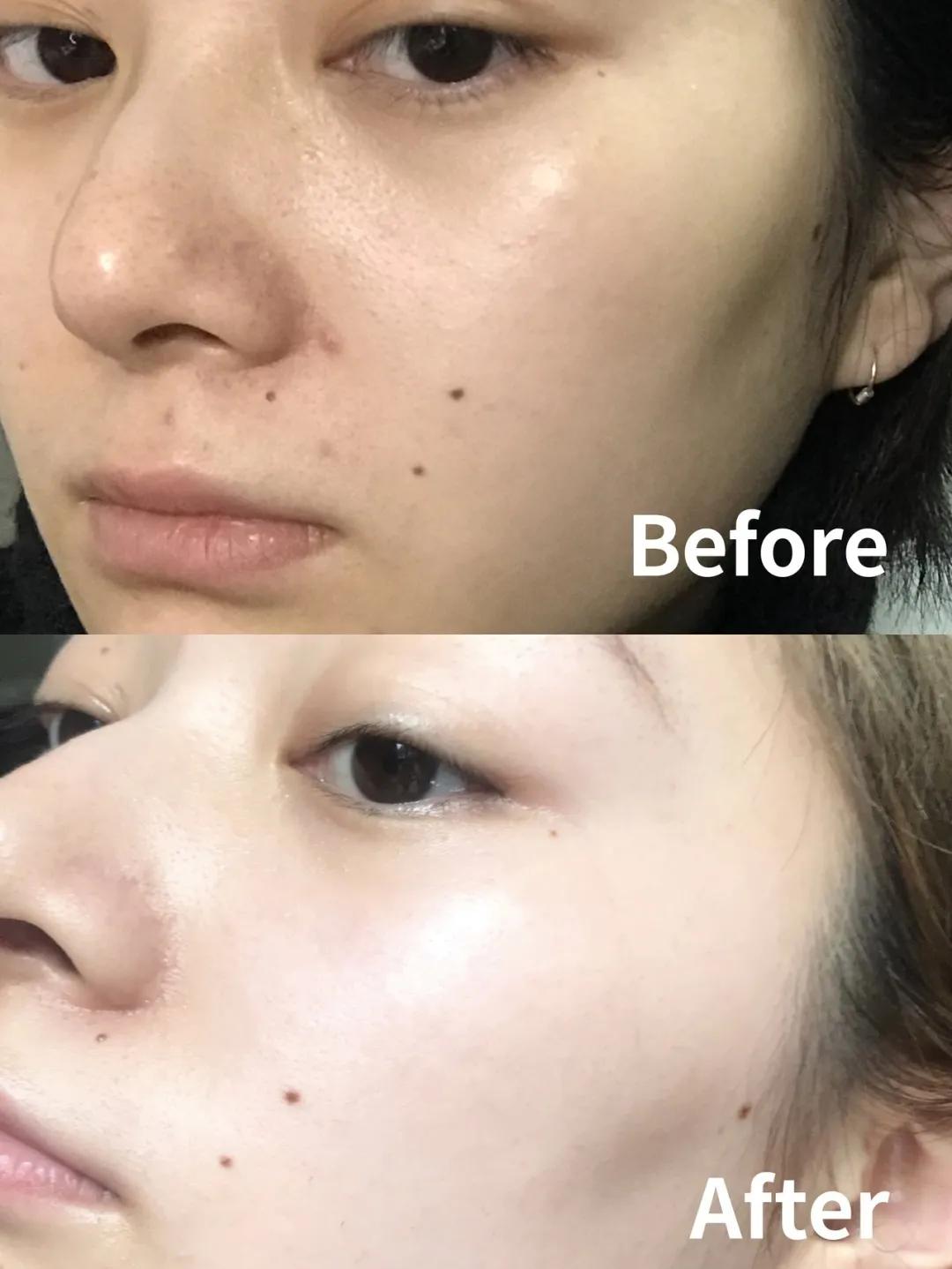 国货哪种面膜祛皱紧致效果最好,推荐一下便宜又好用的国货面膜