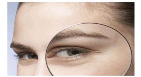 想做眼袋害怕翻眼,想做眼袋手术又怕失明