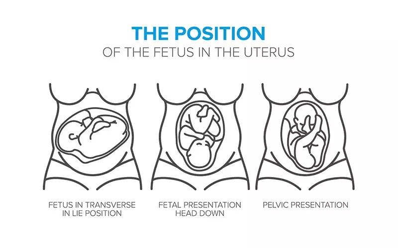 孕妇生孩子的技巧和方法,孕妇怀胎十月各个步骤