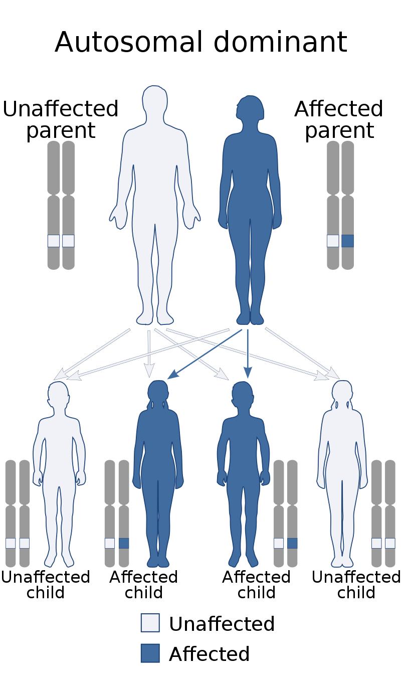 有哪些无指纹的人,没有指纹的人有什么缺点