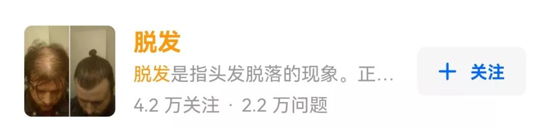 脱发不要错过任何生发产品,脱发生发小知识