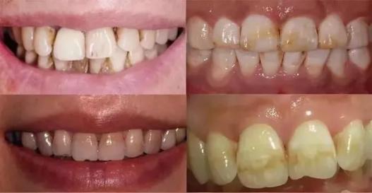 濂冲＋鍙ｈ厰棣欐按鎸佷箙鐣欓,濂介椈鍙ｈ厰鍠烽浘棣欐按