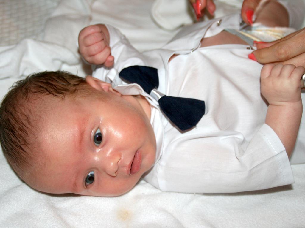 孩子身上的痣能不能点掉,孩子身上的痣