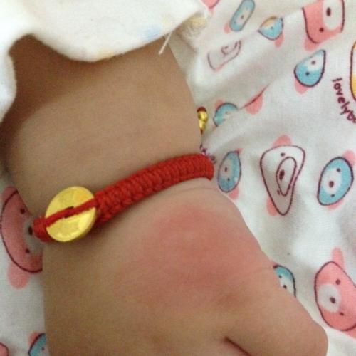 宝宝手指变异什么原因,宝宝手像猪蹄