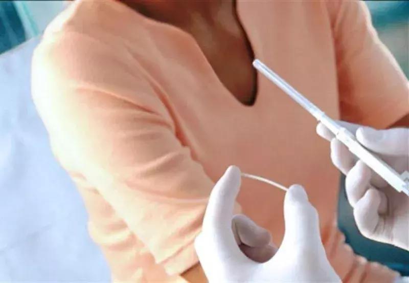 小雨伞破的概率大么,小雨伞失败率