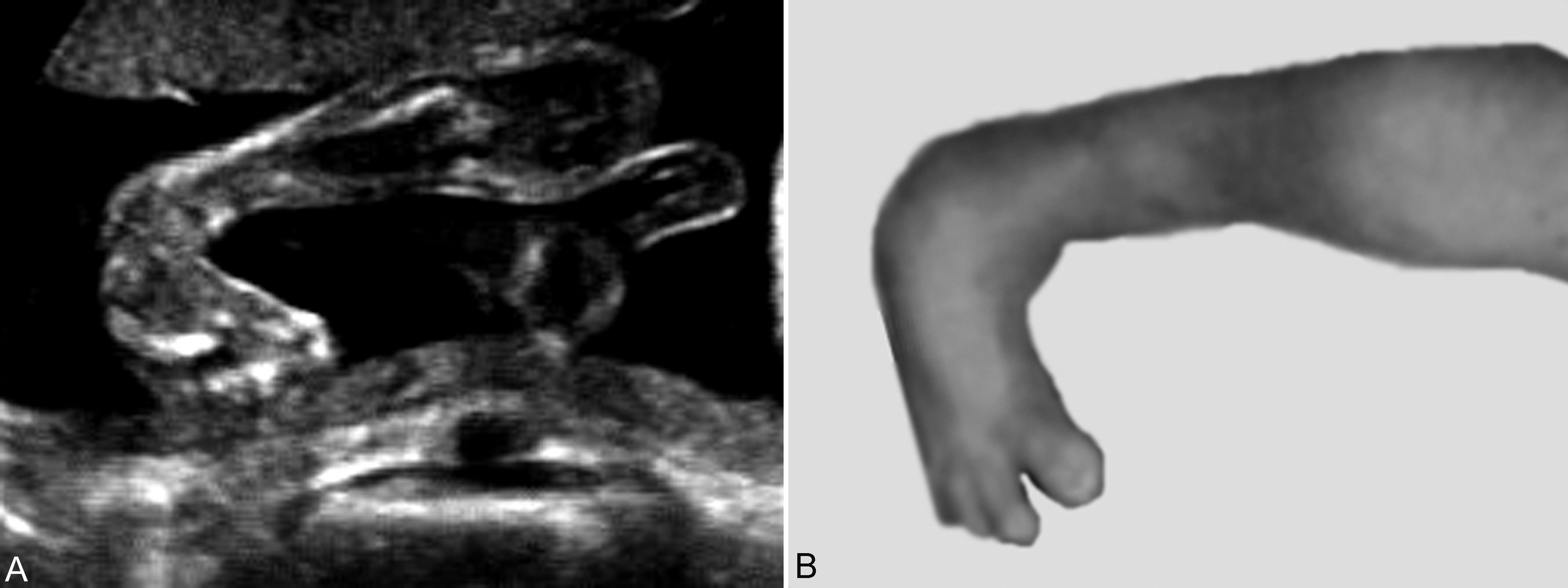 明明白白做ct检查,明明白白做超声
