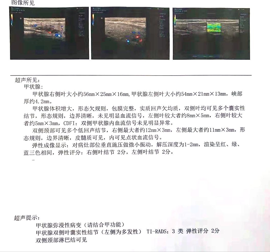 桥本引起甲亢trab抗体会高吗,桥本甲亢的化验单8项