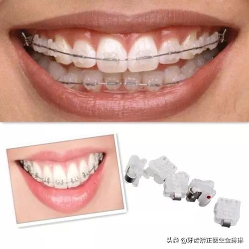 八岁男孩刚换牙牙齿长歪怎么办,小孩牙齿换牙后长歪了怎么办